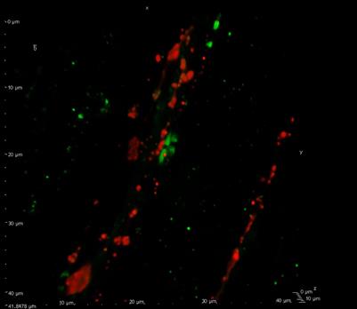 Neuropeptides and the Nodes of Ranvier in Cranial Headaches